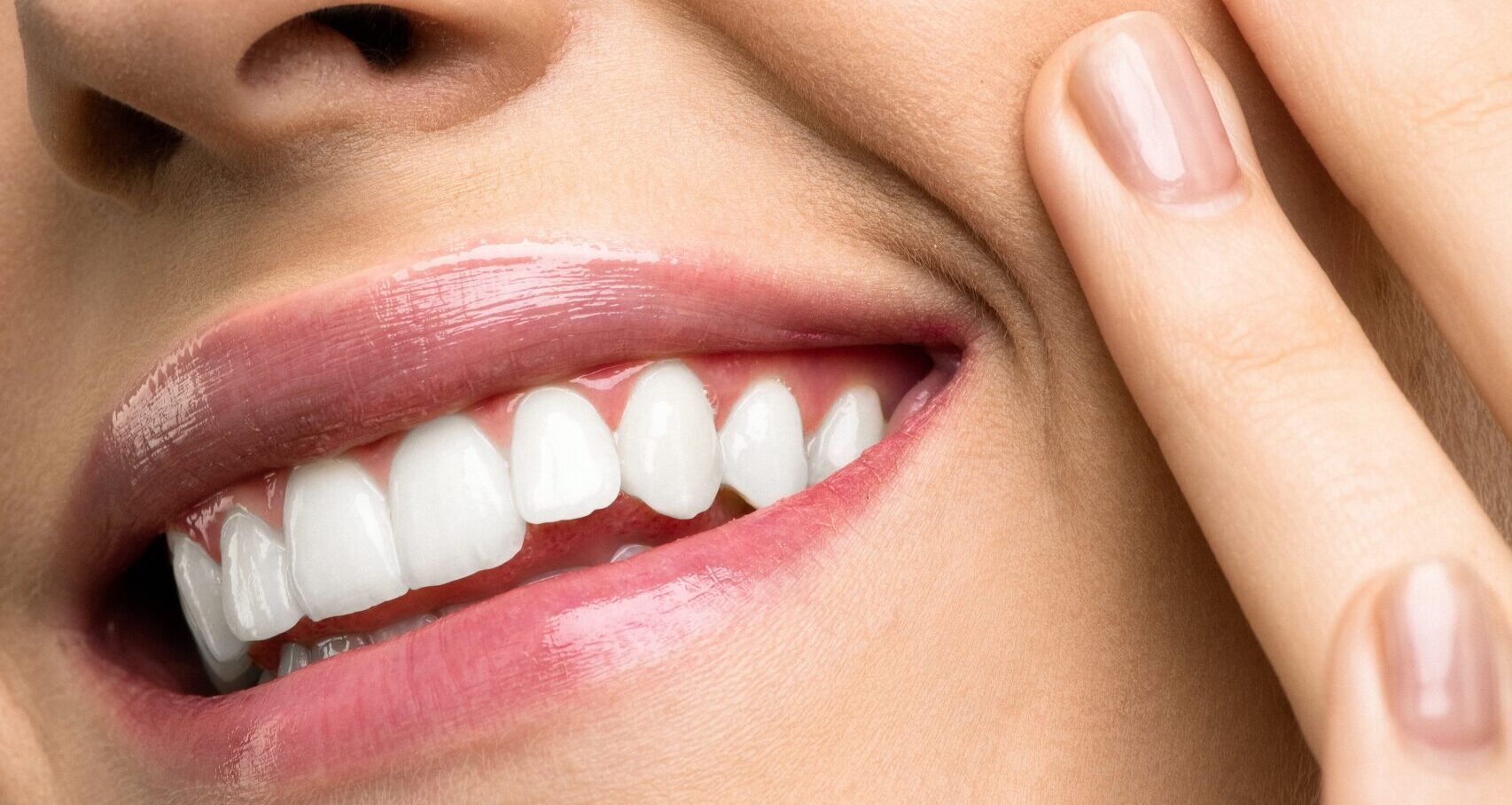 white teeth from south strand dental